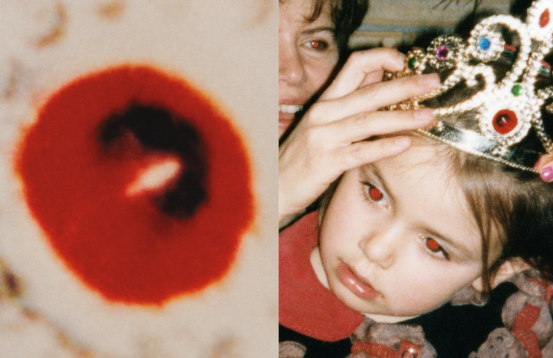 Michel Campeau, Le trompe-l’œil des yeux rouges I, 1998-2005, impression au jet d’encre / inkjet print, 69 × 107 cm